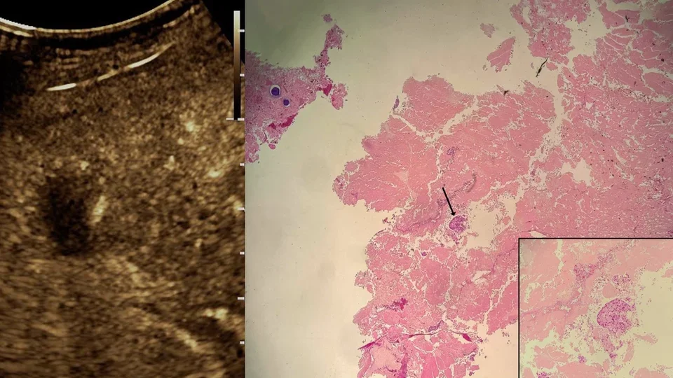 radiograph image next to blood sample slide
