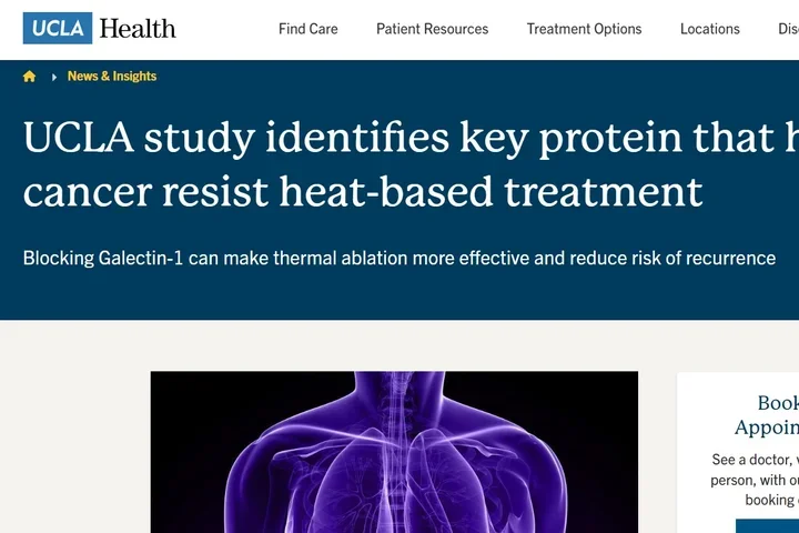 UCLA study identifies key protein that helps liver cancer resist heat-based treatment