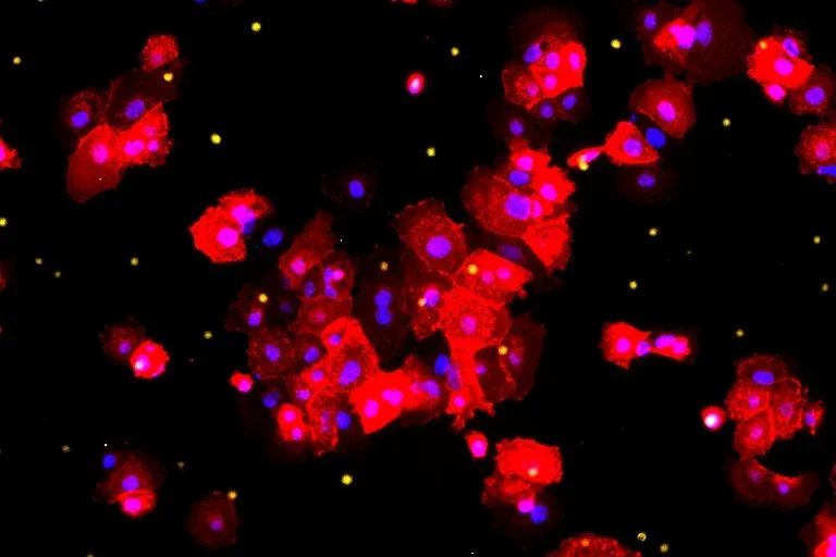 fluorescent pink cells