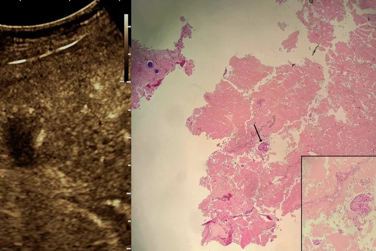 radiograph image next to blood sample slide