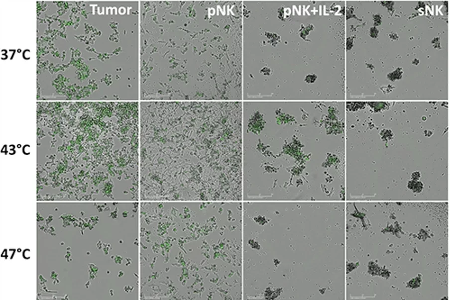 image guided immunotherapy HCC and NK cells