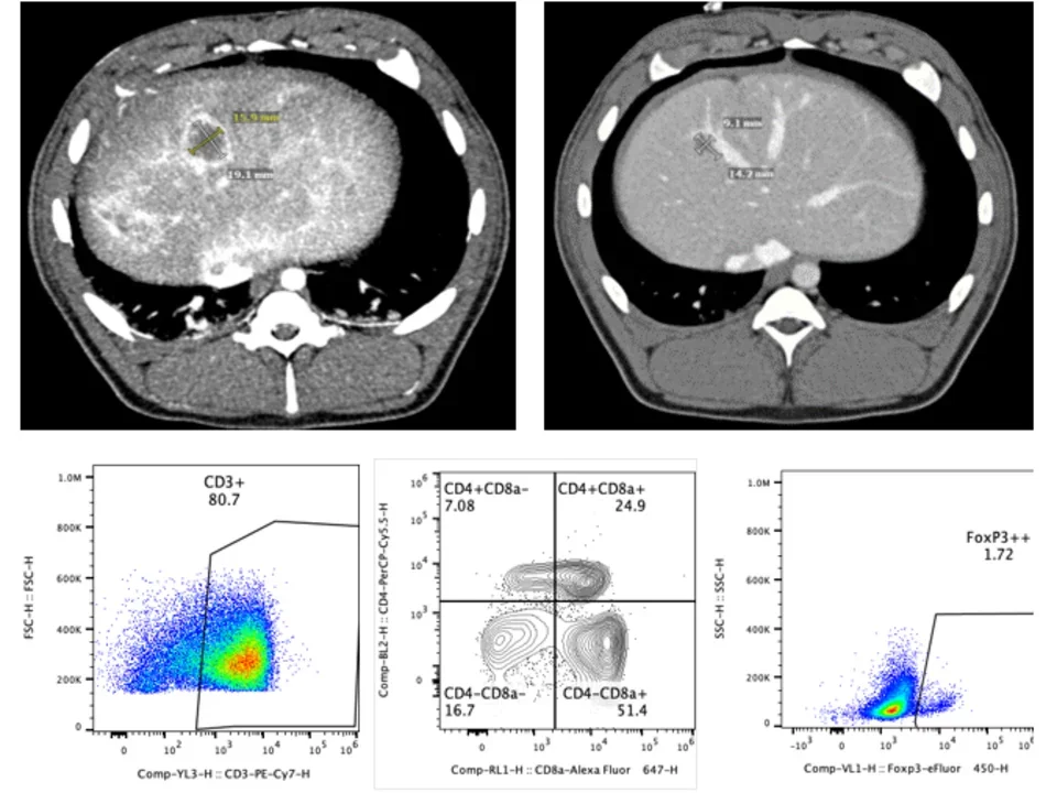 pre and post immunotherapy