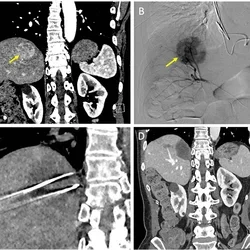 image with four sections each containing a radiology scan