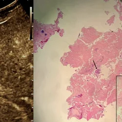 radiograph image next to blood sample slide