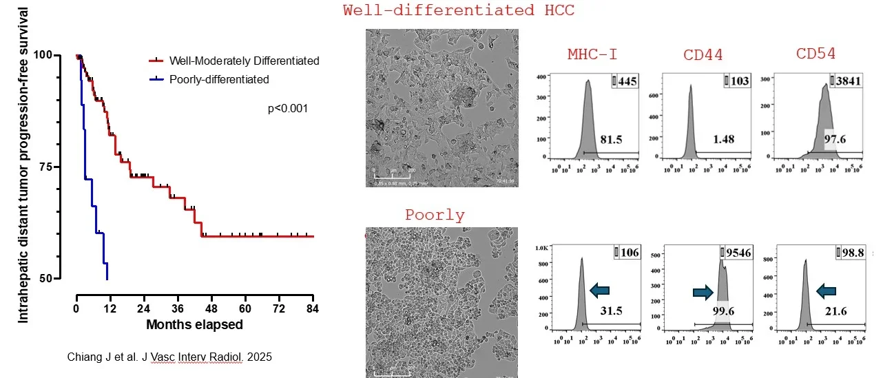 Synergizing locoregional approaches to improve immunotherapy in solid tumors
